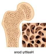 Endocrine Healthy Bone