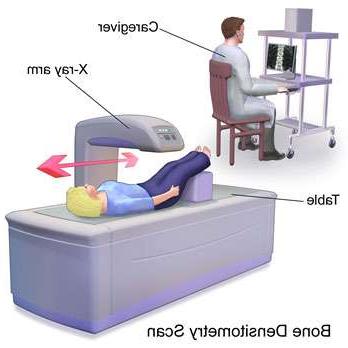 Bone Density Scan