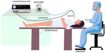 Illustration of RFA Procedure